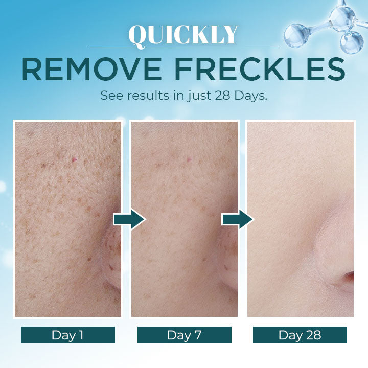 Lanthome™ Triple-Active Brightening Dark Spot Corrector Remover