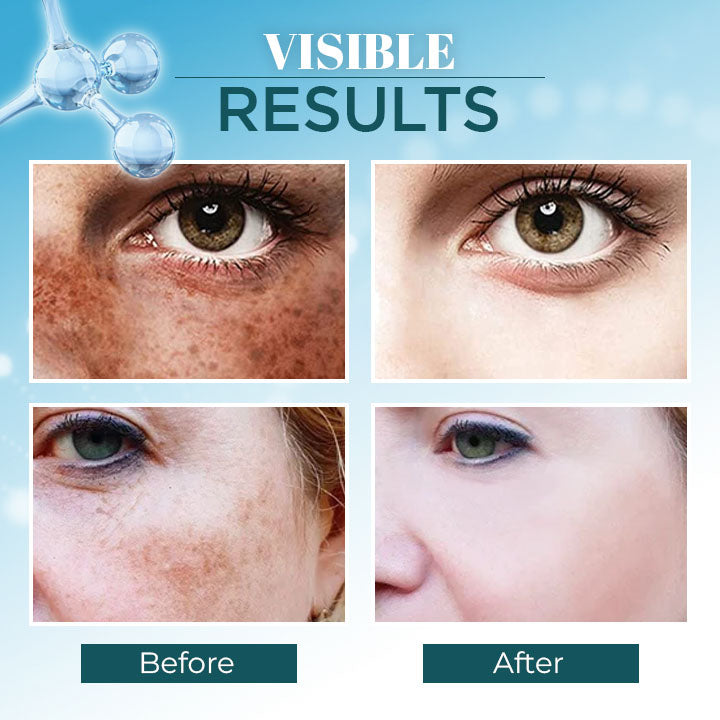 Lanthome™ Triple-Active Brightening Dark Spot Corrector Remover