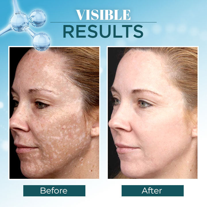 Lanthome™ Triple-Active Brightening Dark Spot Corrector Remover