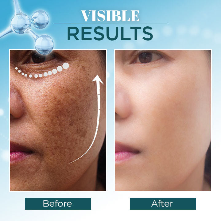 Lanthome™ Triple-Active Brightening Dark Spot Corrector Remover