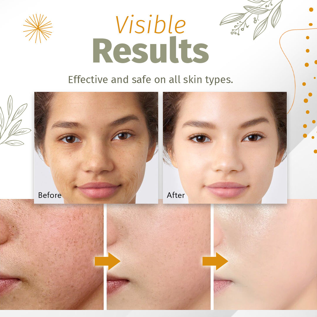 New Organic Skin Spot Solutions Serum