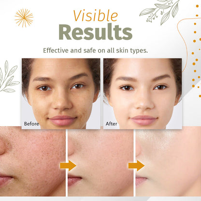 New Organic Skin Spot Solutions Serum