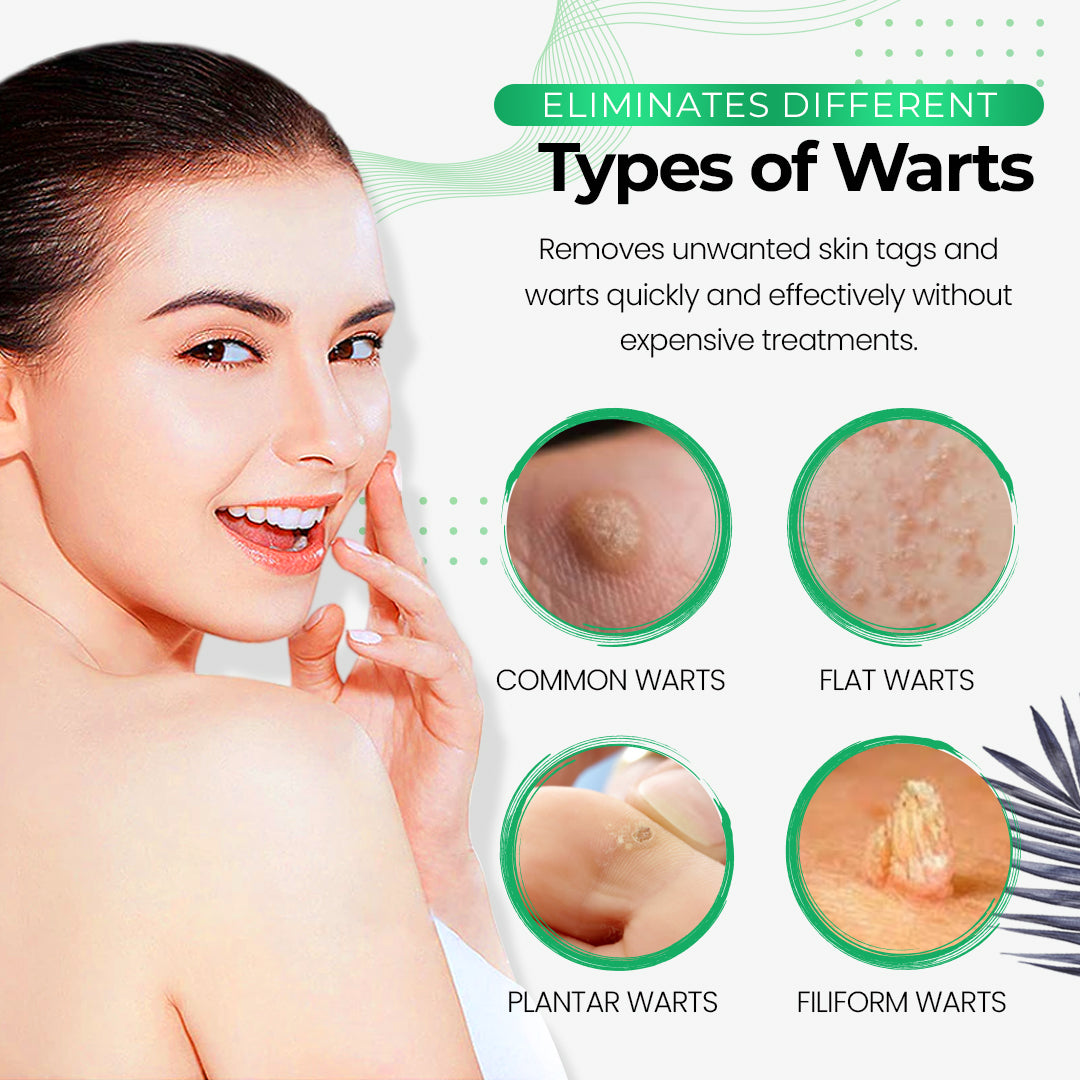 SmooothSkin™ Wart Eliminator Soap