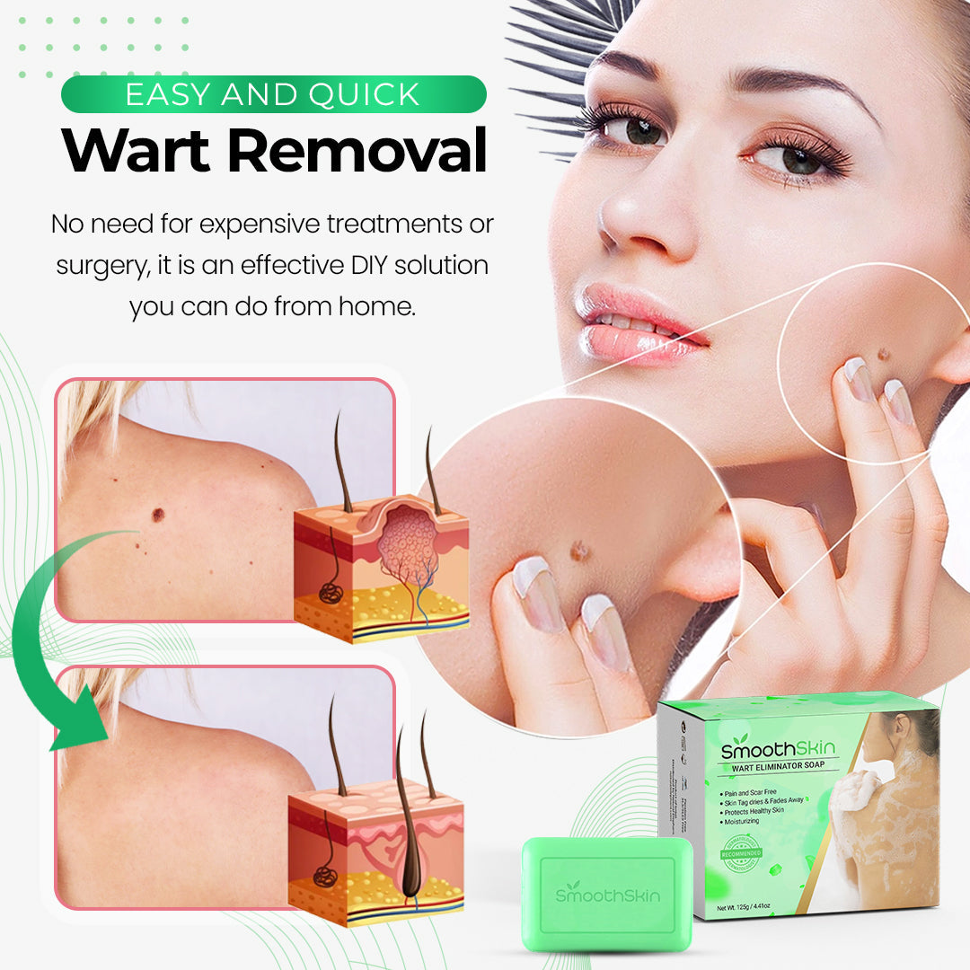 SmoothSkin™ Wart Eliminator Soap ⭐