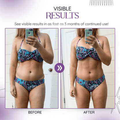 Zakdavi Kenyan Purple Leaves Weight Loss Cream💜