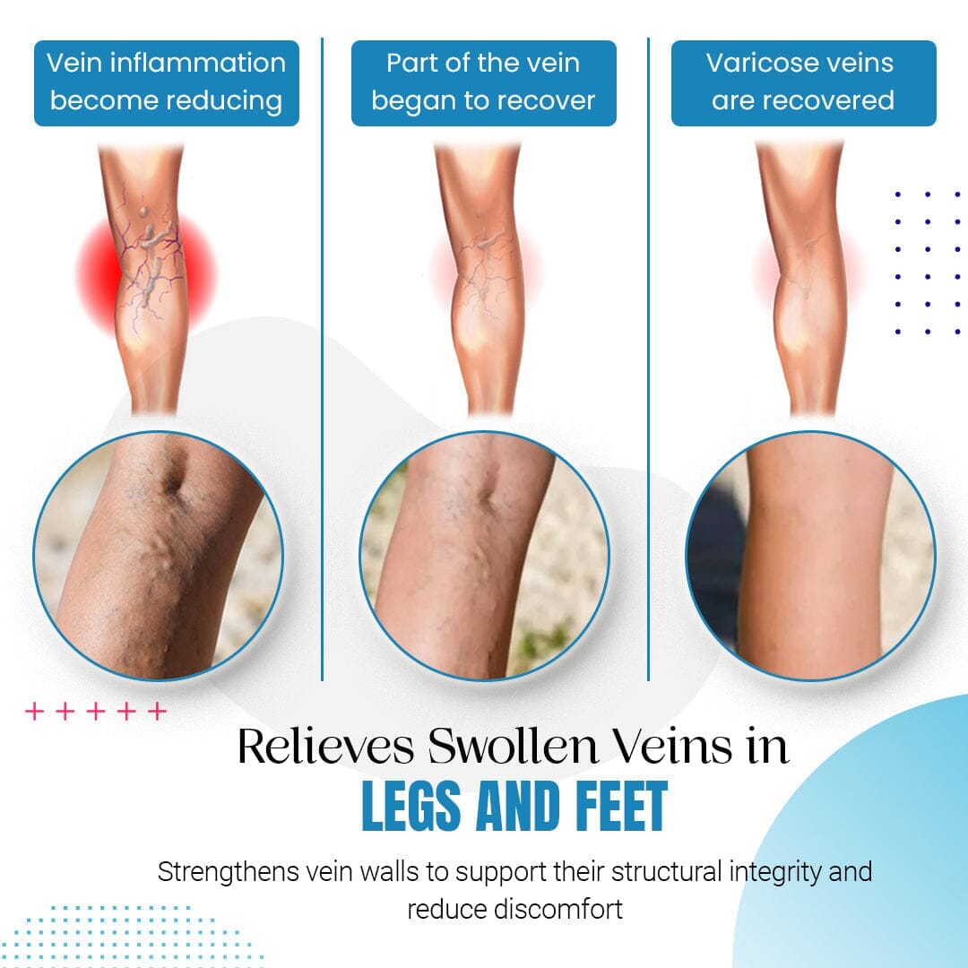 ZAKDAVI™ Varicose Veins Treatment Spray