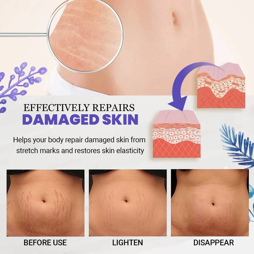 EarthBlend™ Stretch Mark Vanisher